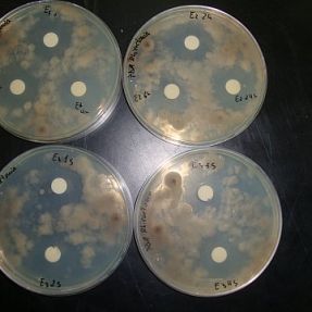 Actividad biocida exposición luz ultravioleta