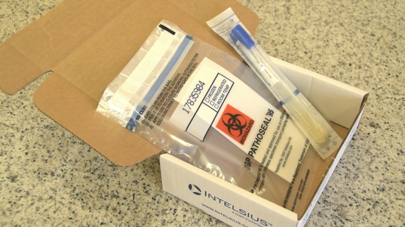 Todos los análisis de coronavirus realizados en CTAEX han dado negativo